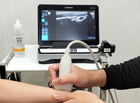 超音波画像観察装置を使用した検査